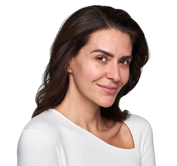 skinvive santa barbara before