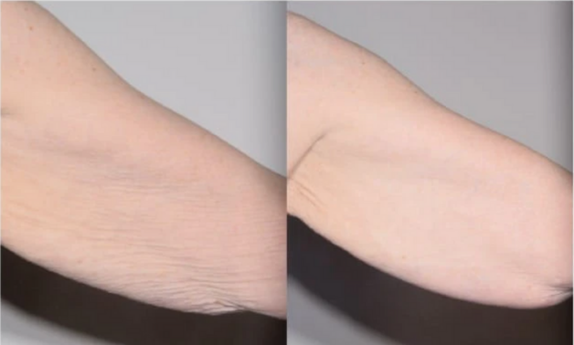 Alastin TransFORM