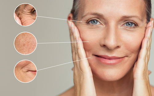 signs of aging Santa Barbara