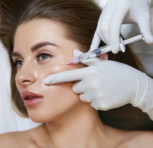 top filler techniques santa barbara