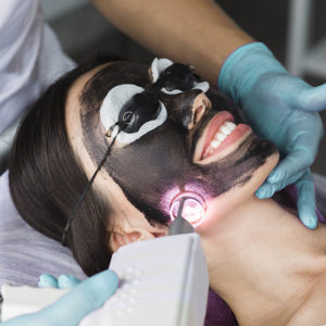 carbon laser peel Santa Barbara