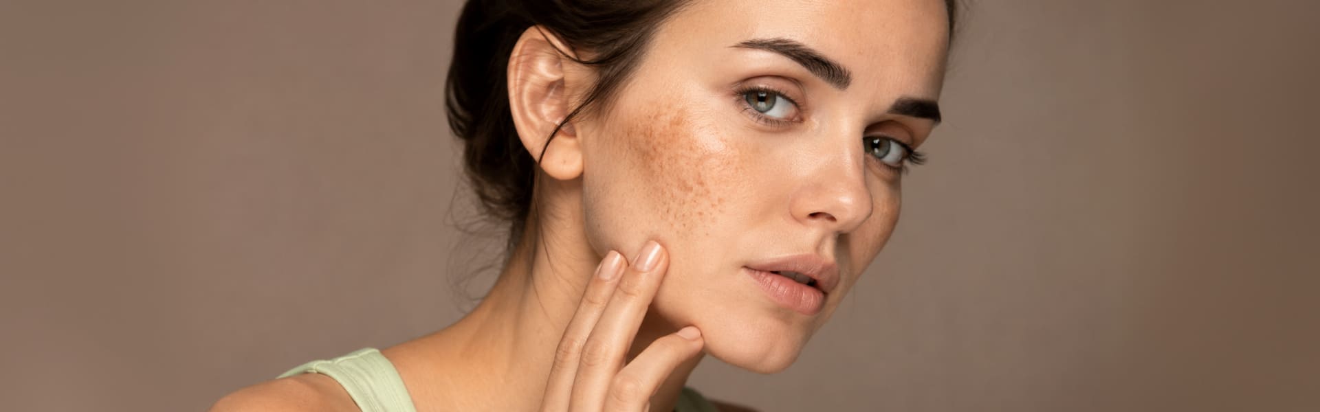 Age Spots & Sun Damage