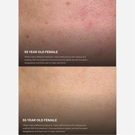 Cynoglow Treatments