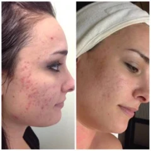 Scar