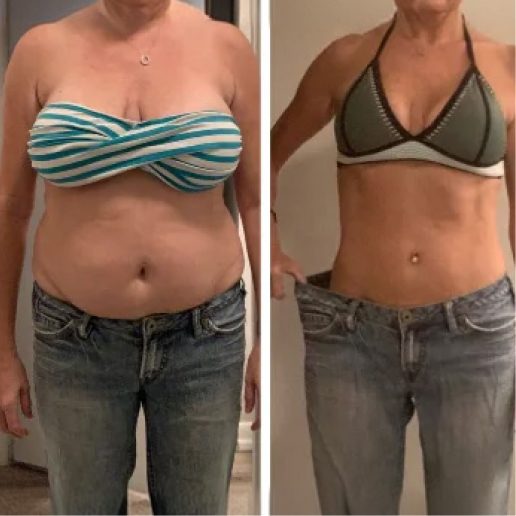Semaglutide Treatment