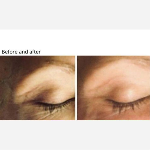 Skin Tightening & Cellulite Treatments