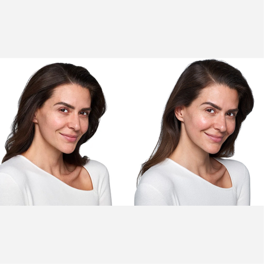 SkinVive Treatment