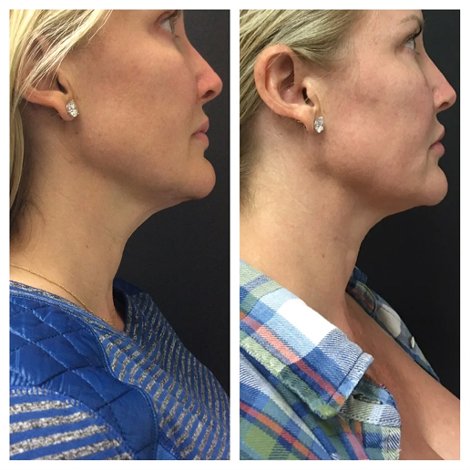 Real Patient Results