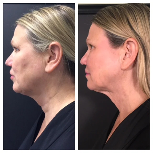 Real Patient Results