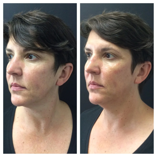 Real Patient Results