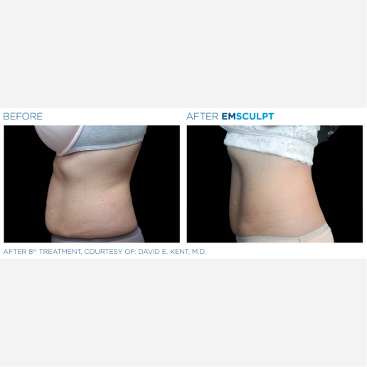Real Patient Results