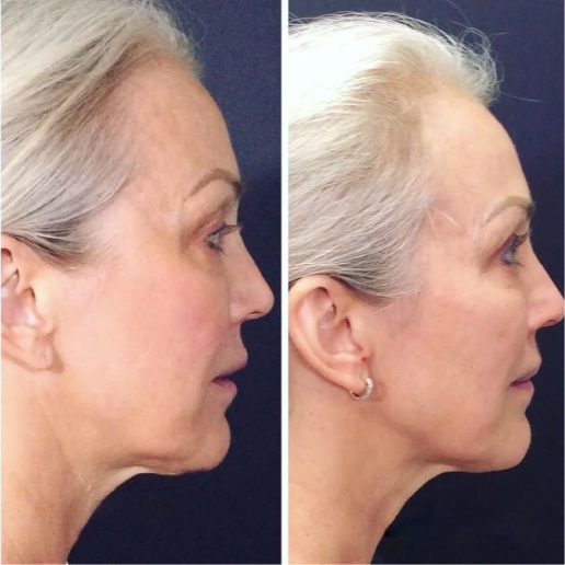Real Patient Results