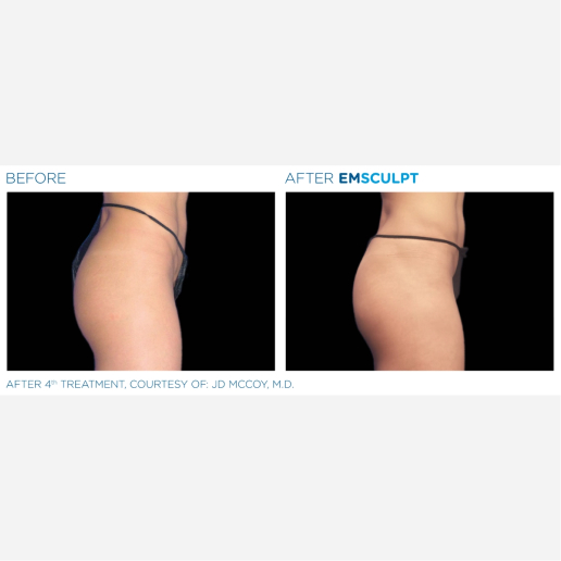 Real Patient Results