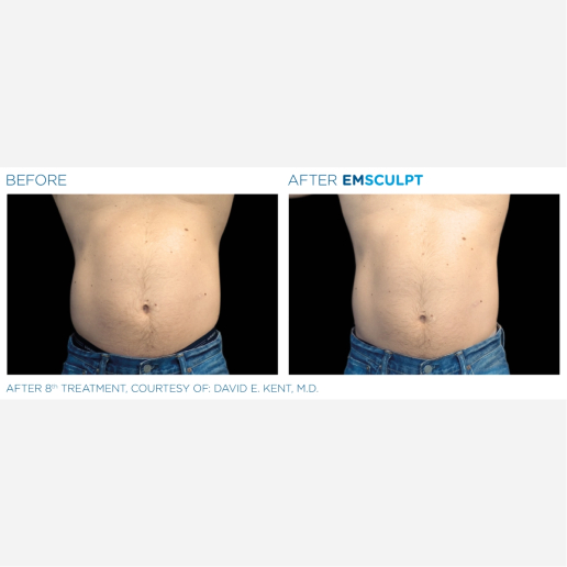 Real Patient Results